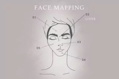 acne diagram of the face