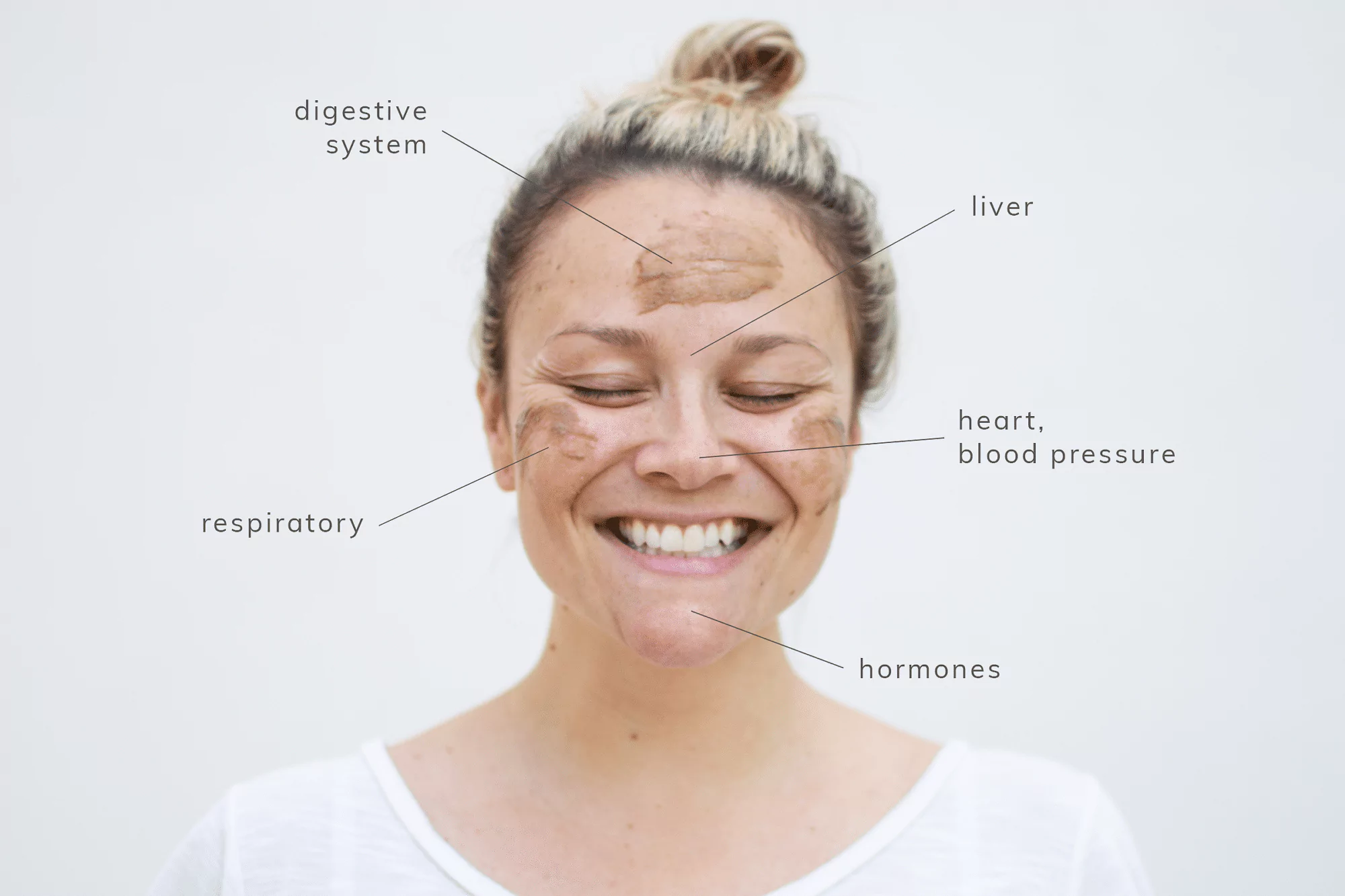 Face mapping your acne and what it means on your face revealed